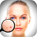 Face Enhancer: Blemish Remover